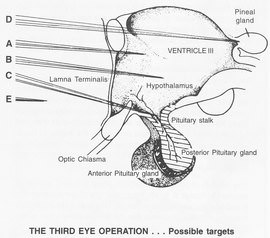 Third_Eye_Operation.zip